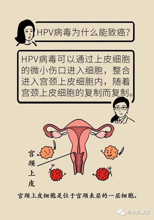 hpv感染就像宮頸得了一次感冒