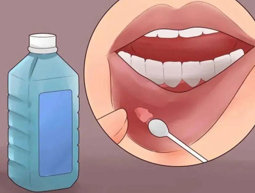 体内有癌嘴先知口腔出现这5种迹象可能是癌症在靠近