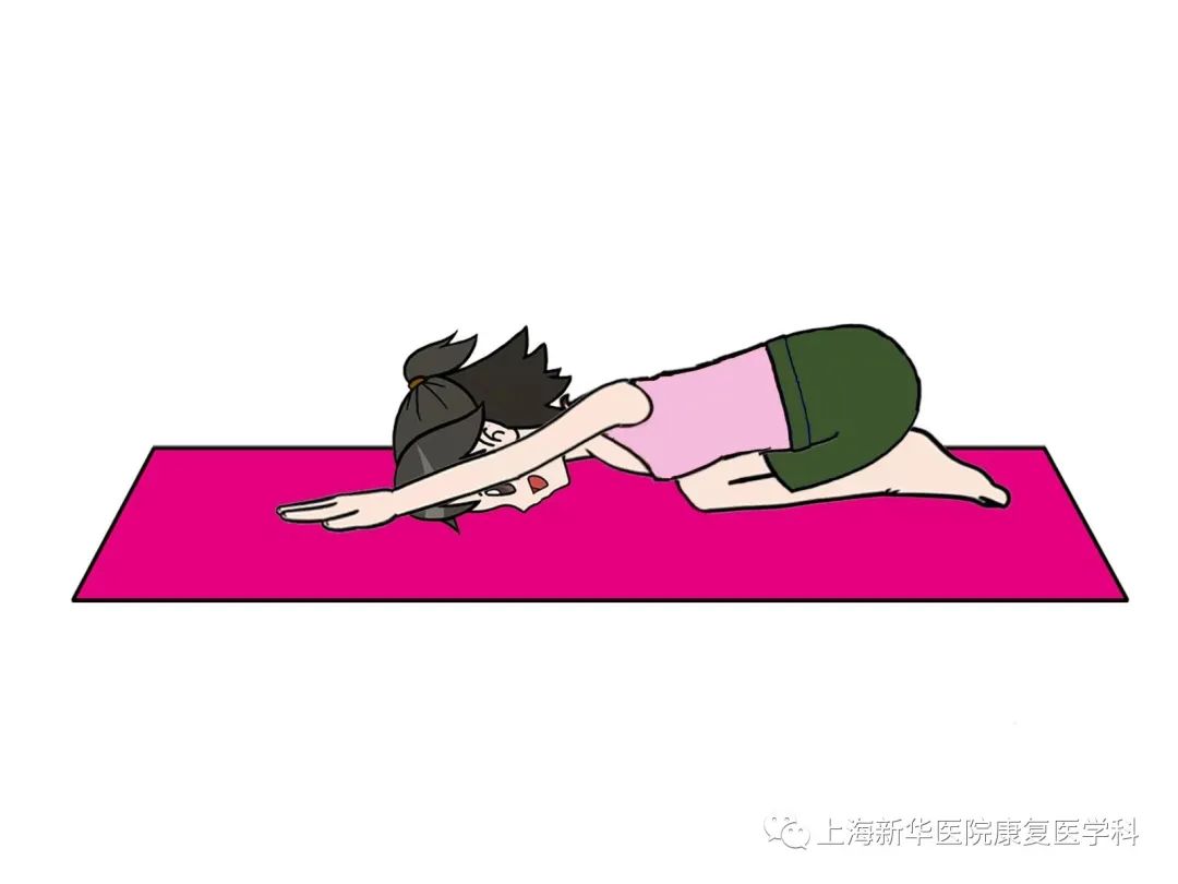 带您了解下交叉综合征