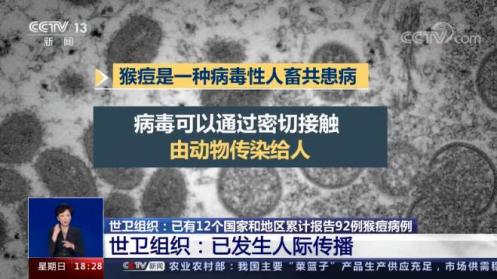 核酸用什么试剂鉴定伯杰医疗猴痘病毒核酸检测试剂盒 (PCR-荧光探针法) 获欧盟CE准入！_https://www.jmylbn.com_新闻资讯_第1张