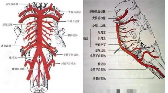 延髓背外侧综合征,是指由于小脑后下动脉(pica)或(和)椎动脉病变所