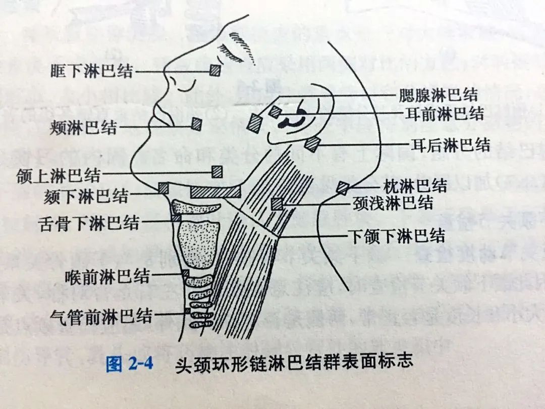 颈部淋巴结分布图片图片