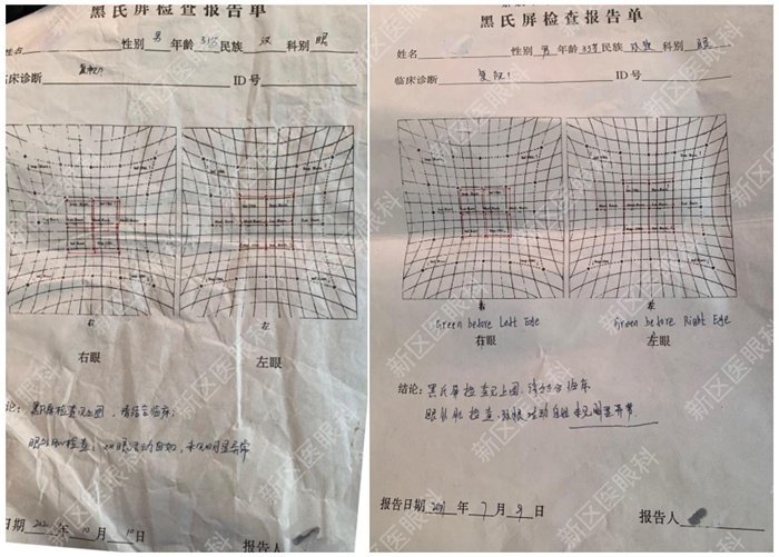 为什么要说焦度全国爱眼日｜从1例近视术后复视的治疗说开去_https://www.jmylbn.com_新闻资讯_第2张