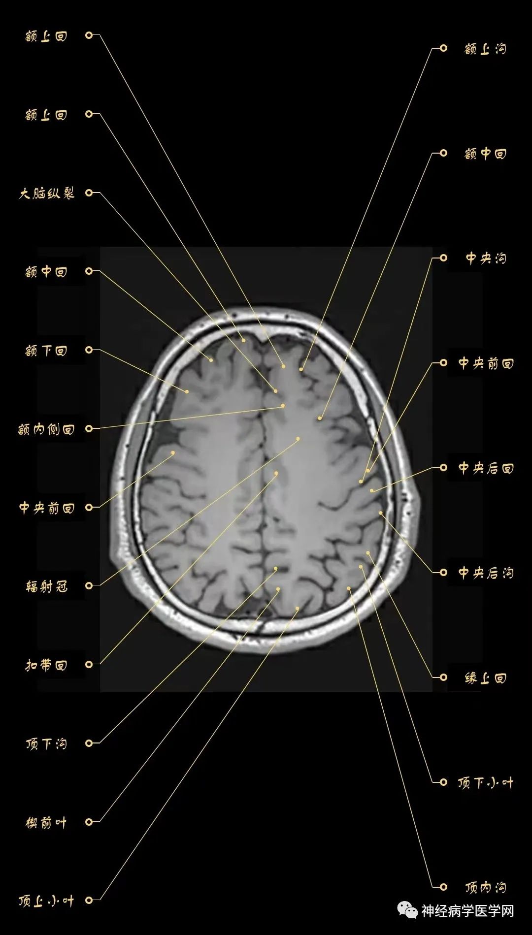 高清颅脑mri最全轴位影像解剖人手一册