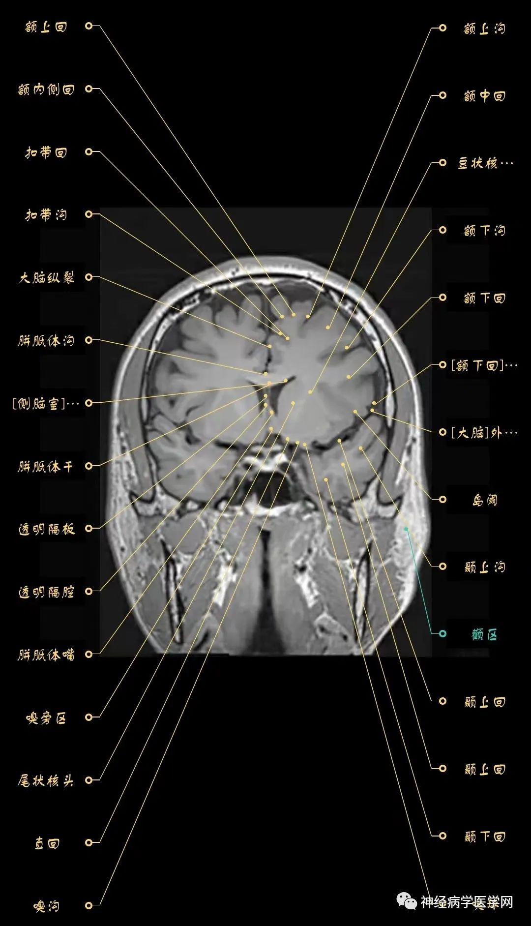 高清颅脑mri最全轴位影像解剖人手一册