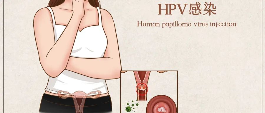 感染hpv后怎么做才能转阴看完放心多了