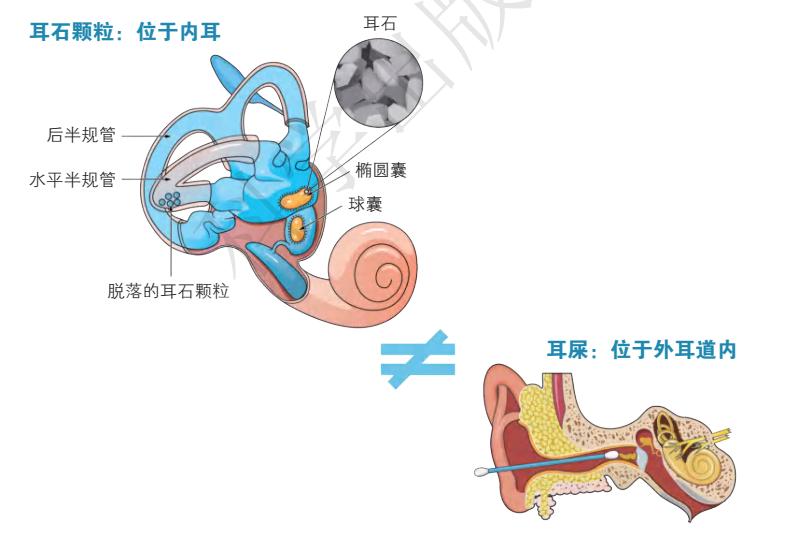 耳石颗粒位于内耳,而耳屎位于外耳道内(图1)