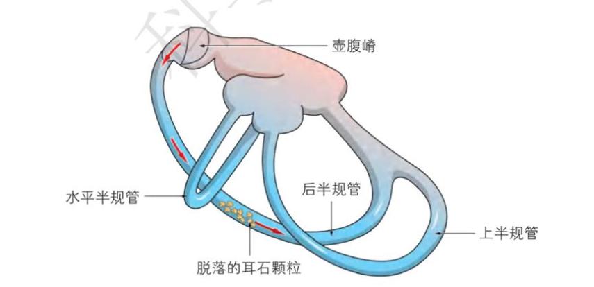 眩晕居家自助专辑系列之三:六问耳石症