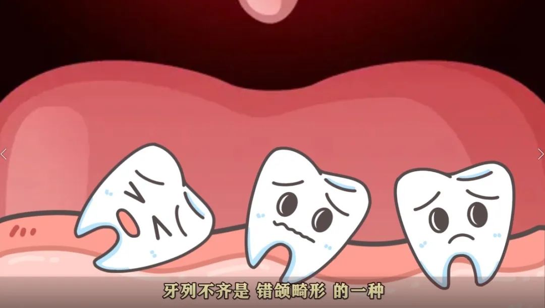 有医说医67牙列不齐早治疗生命健康七堂课微课系列