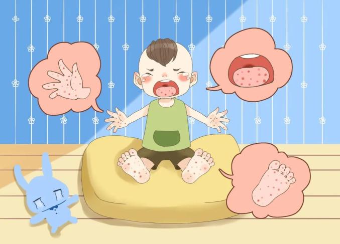 夏季幼儿常见传染病之手足口病，这些要点需知晓