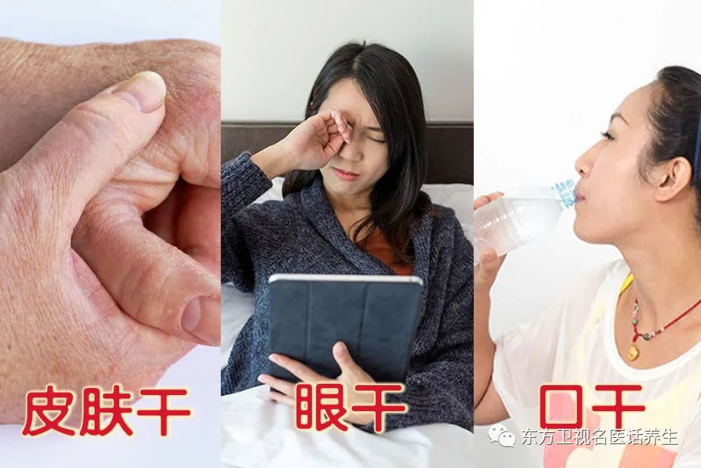 口干眼干皮肤干别急滋阴食材大揭秘