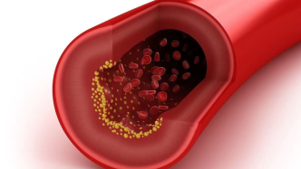 软化血管真的存在吗？4种食物“追捧”了几十年，这是伪科学