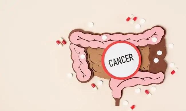 结肠癌卡通图片图片