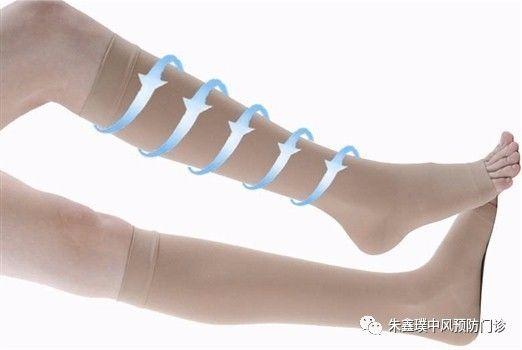 血管闭合系统是什么“下肢静脉曲张”的最佳治疗_https://www.jmylbn.com_新闻资讯_第2张