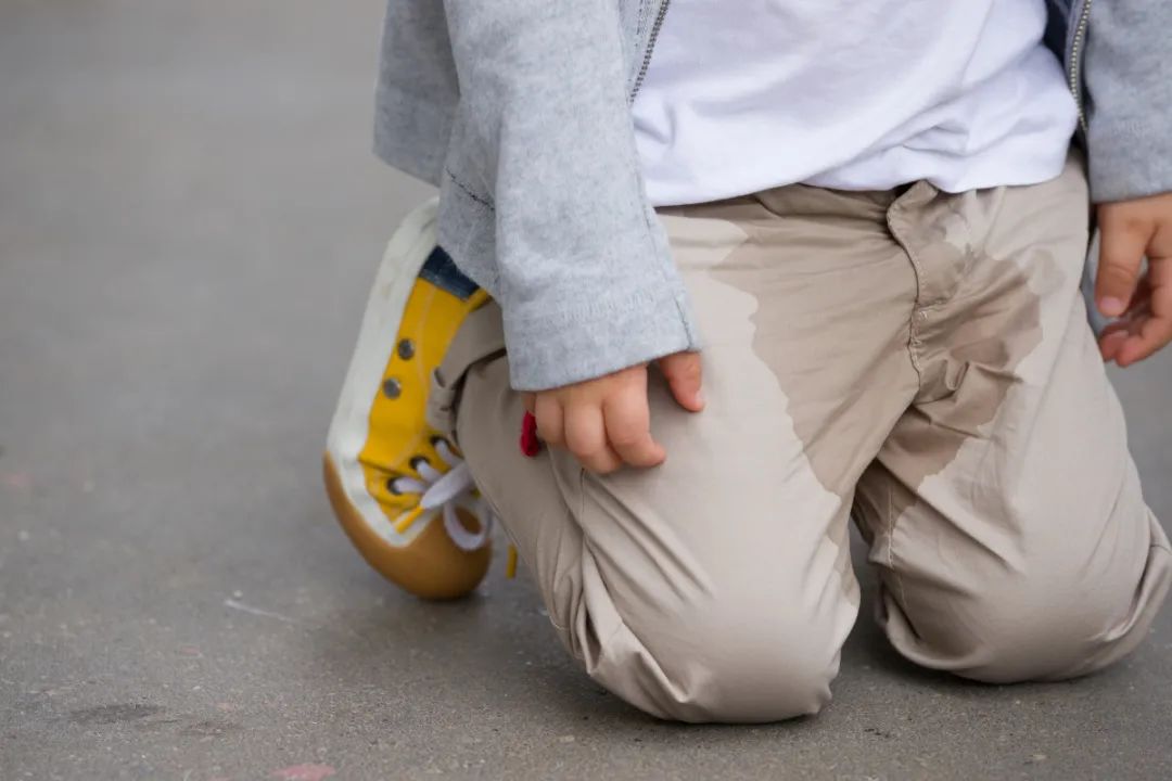 兒醫大咖說06孩子經常尿床有時白天也會尿褲子如此尷尬怎麼破