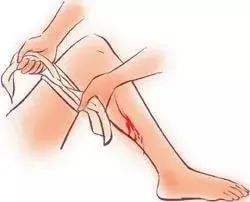 缝伤口怎么打结意外太多，创伤后如何开展救治与自救_https://www.jmylbn.com_新闻资讯_第2张