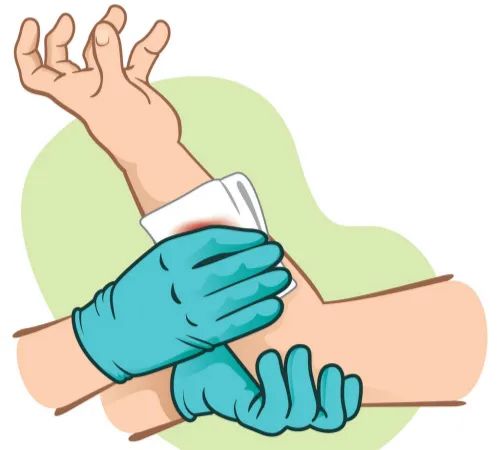 缝伤口怎么打结意外太多，创伤后如何开展救治与自救_https://www.jmylbn.com_新闻资讯_第7张