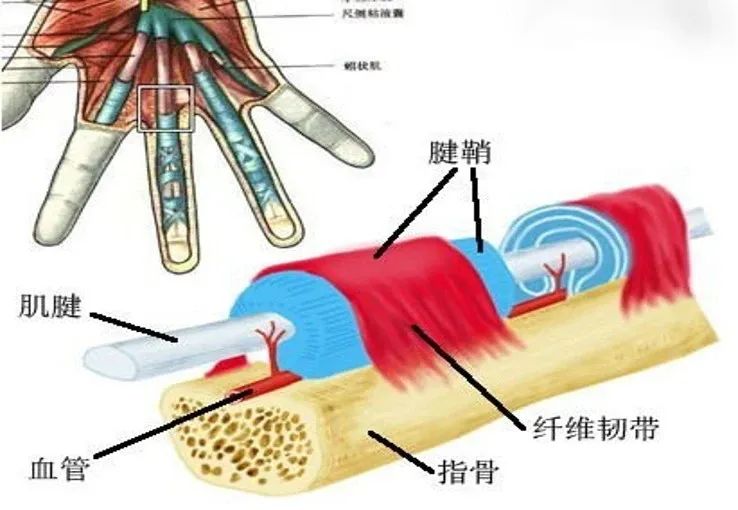 手指伸不直還會咔咔響腱鞘炎一定要手術嗎