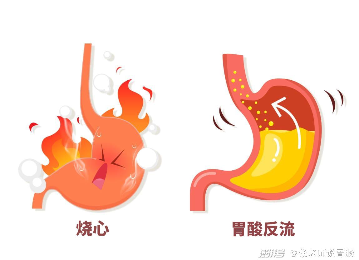 反流性食管炎模型-【动物造模】|反流性食管炎|十二指肠|食管|韧带|细胞炎症|-健康界
