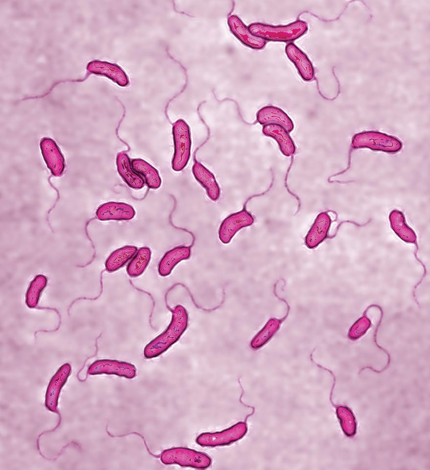 不产生毒素的霍乱弧菌菌株不会引起霍乱