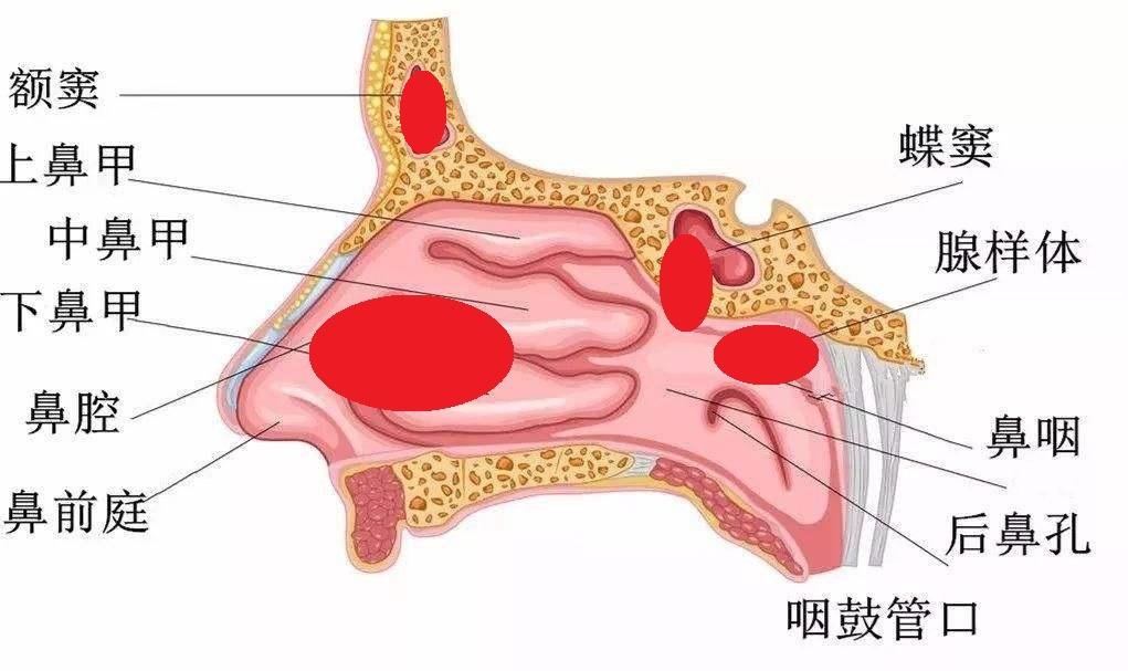 科普回吸涕带血可能和鼻咽癌有关