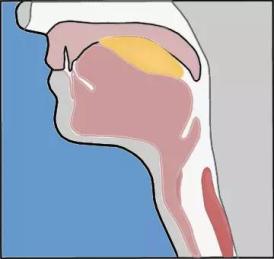 突然吞嚥困難和嗆咳腦中風來襲