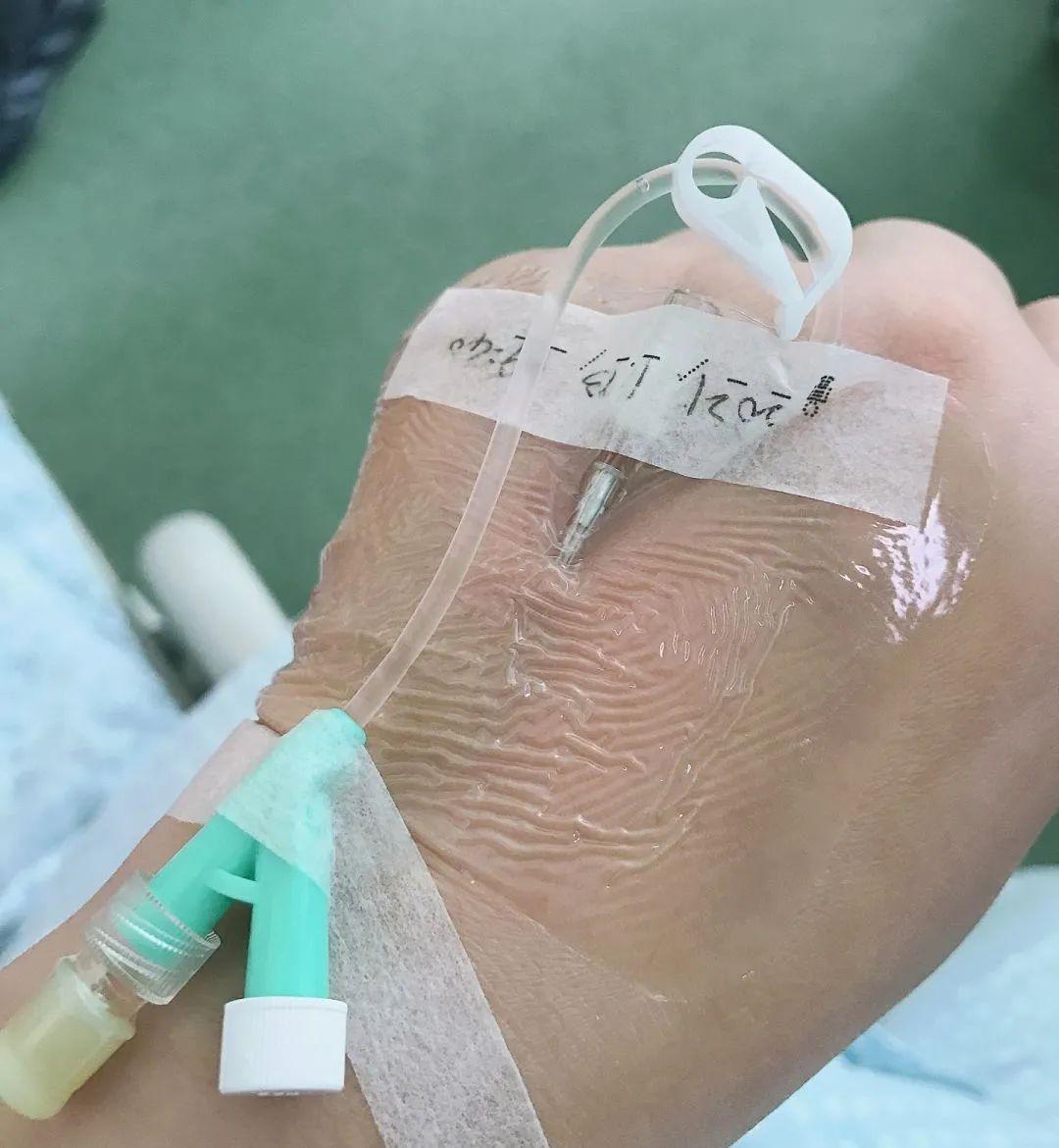 什么是手术无影灯剖宫产手术丨从无影灯上偷看自己被开刀_https://www.jmylbn.com_新闻资讯_第2张