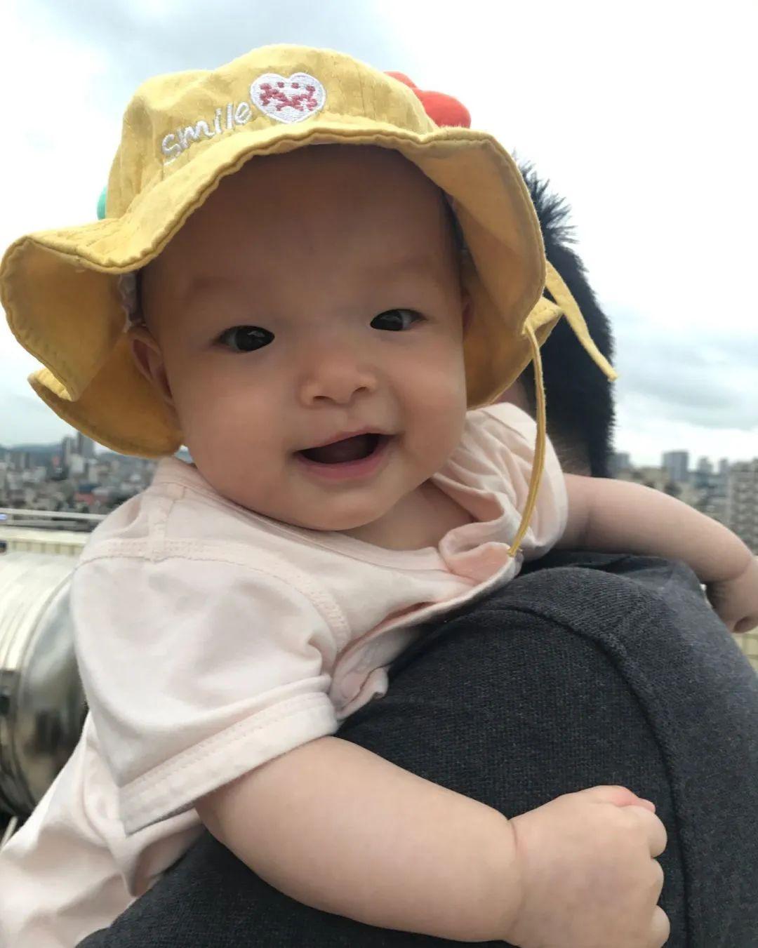 什么是手术无影灯剖宫产手术丨从无影灯上偷看自己被开刀_https://www.jmylbn.com_新闻资讯_第5张