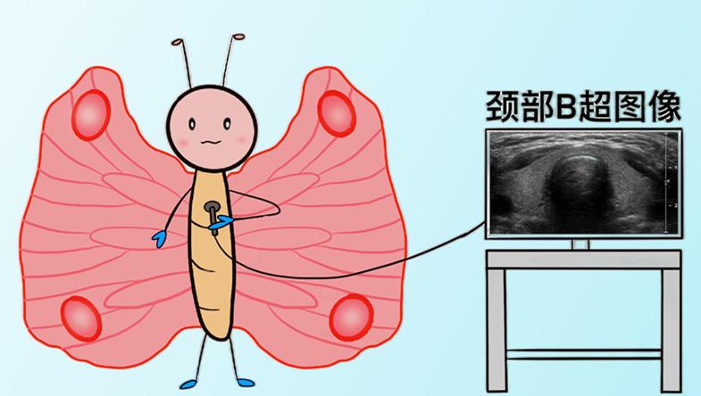 甲状腺结节卡通图片