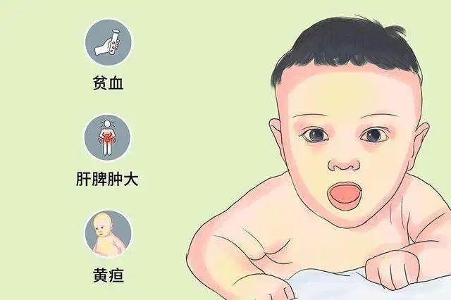 核黄疸的宝宝图片图片
