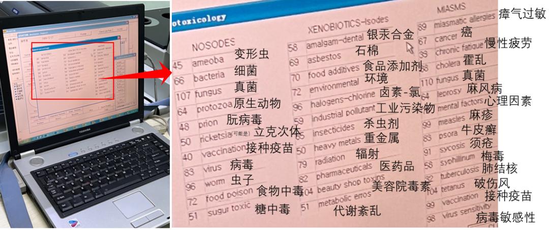 医院尿检仪器怎么卖医生说我可能得癌症？加钱做了299的量子体检后，我想一头创死_https://www.jmylbn.com_新闻资讯_第5张