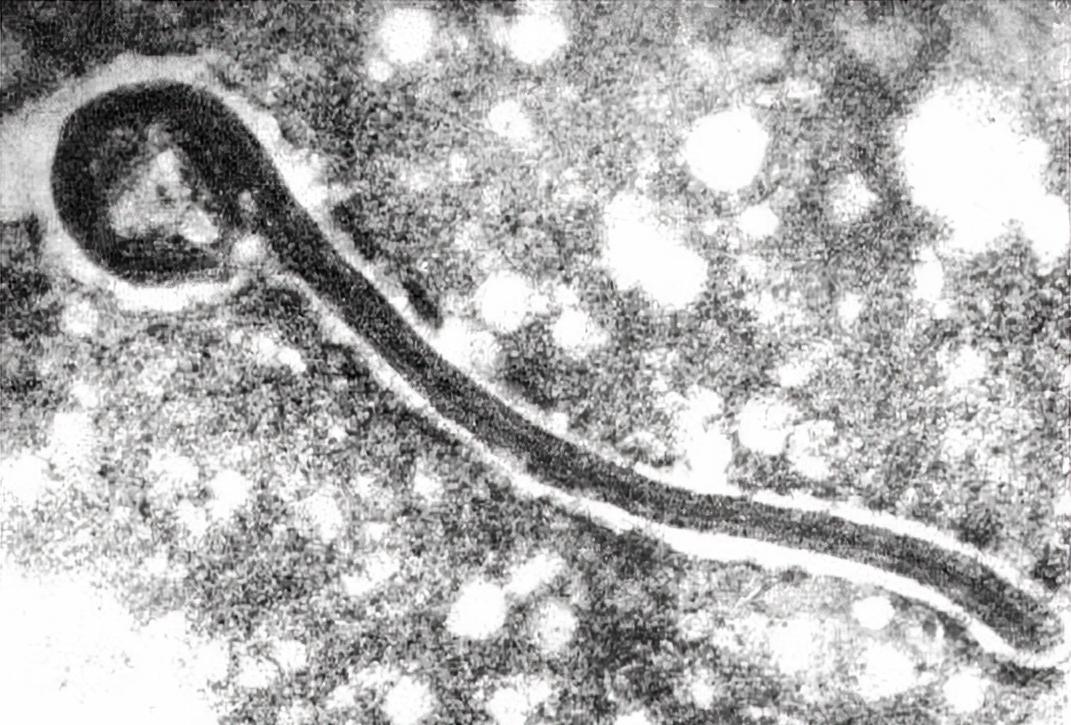 马堡病毒图片