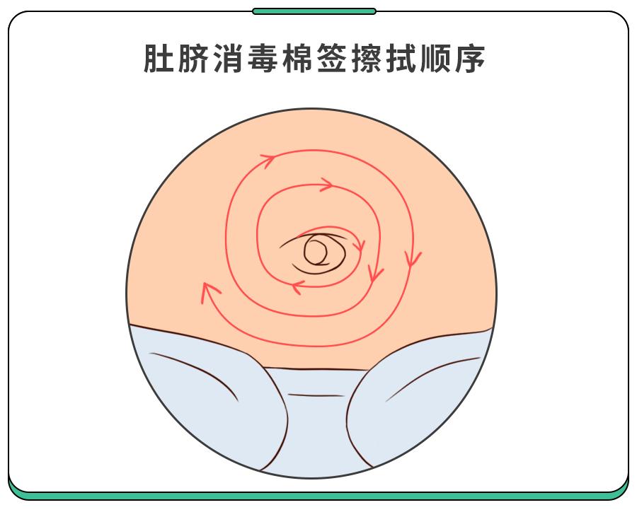 就算脐带脱落了仍要注意观察和消毒,脐带如果护理不好可容易得脐炎!