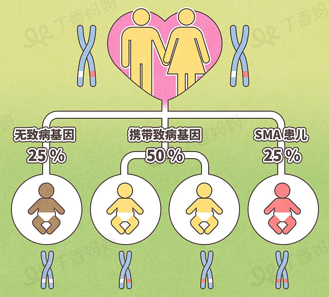 sma 是一种常染色体隐性遗传疾病[1],会让胎儿,婴