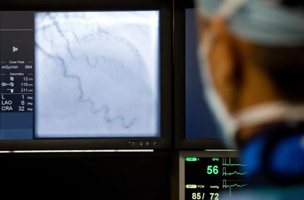 心脏是怎么固定的男子心肌梗死，检查血管没有狭窄，没有闭塞_https://www.jmylbn.com_新闻资讯_第3张