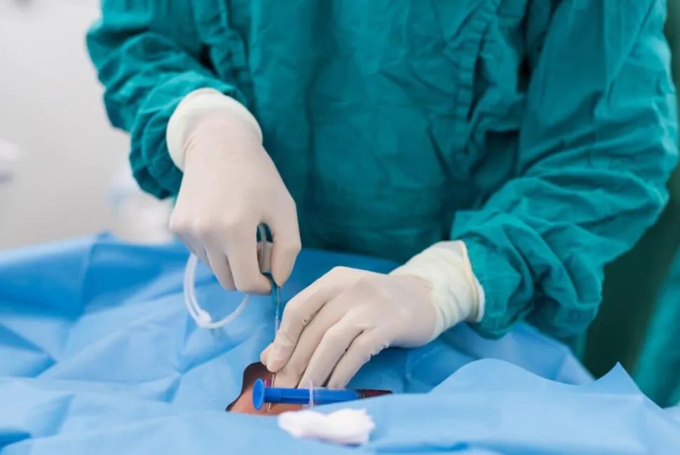 心脏是怎么固定的男子心肌梗死，检查血管没有狭窄，没有闭塞_https://www.jmylbn.com_新闻资讯_第5张