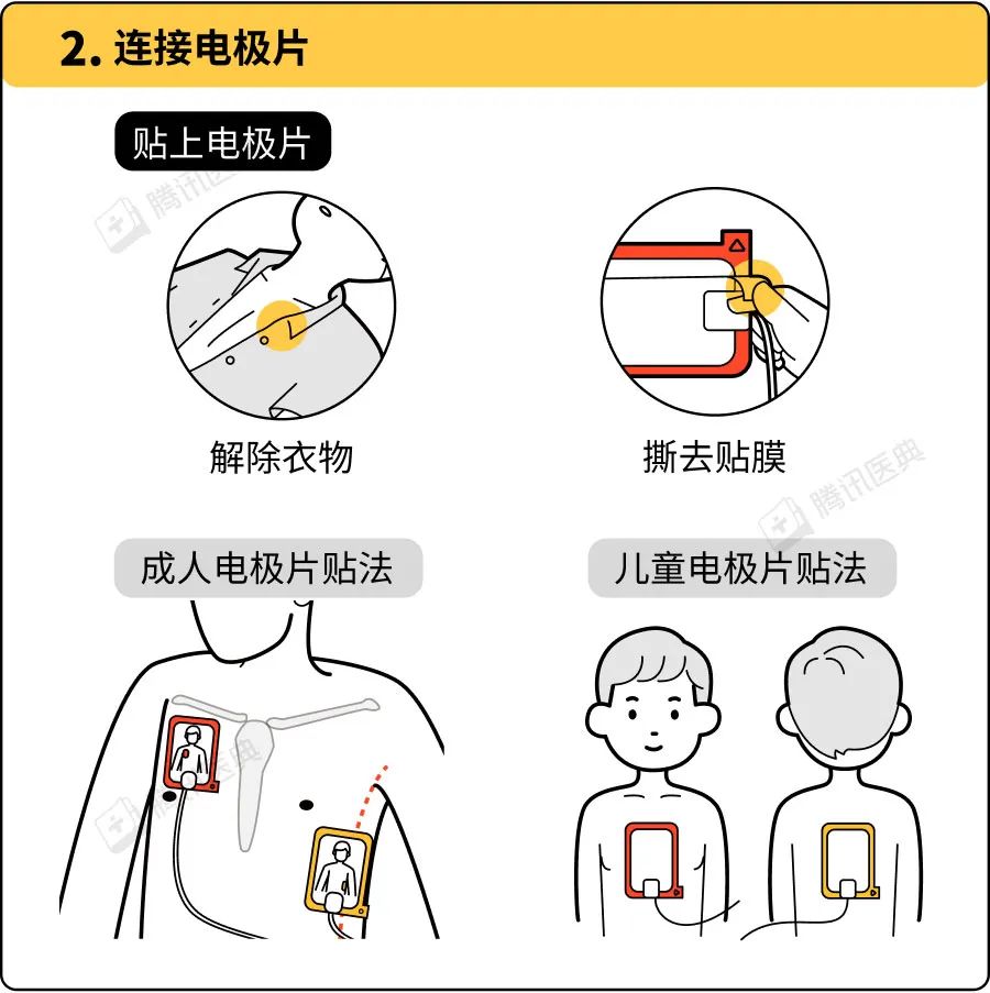 但愿用不到,一定要知道,如何正确使用救命神器aed?