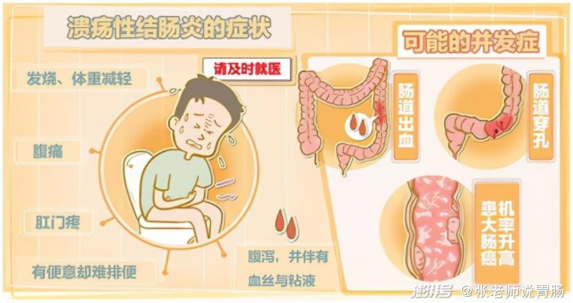 经常拉肚子不舒服?这可能也是溃疡性结肠炎在作怪,别大意