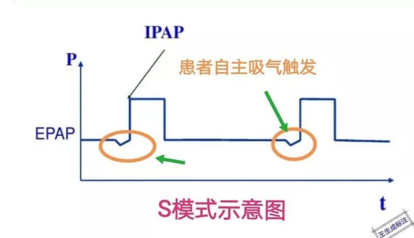 什么是无创制氧机不会用无创呼吸机?不存在的-上海聚慕医疗器械有限公司