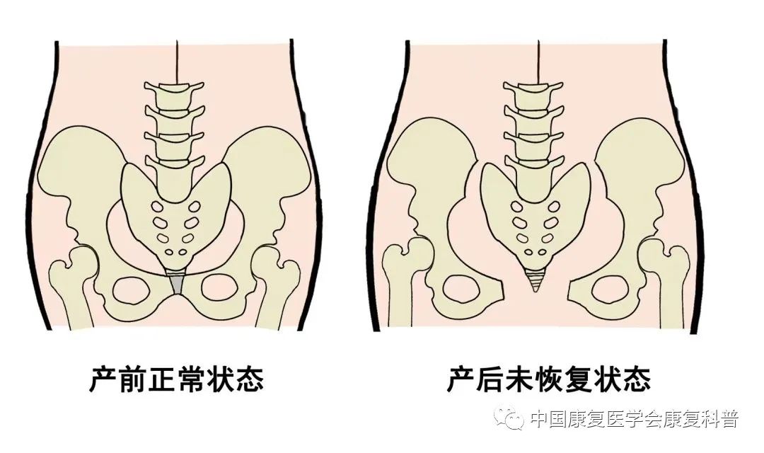 耻骨联合的活动甚微