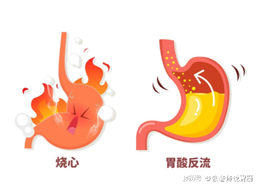 胃酸反流烧心感觉好难受教你做好饮食分期控制及日常保健