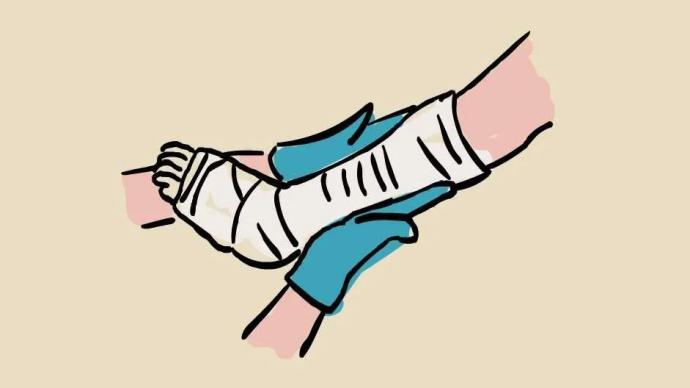 跟腱断裂,打上石膏是不是就能连接上了?