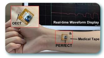 港大工程研究团队开发微型可穿戴生物电子传感系统