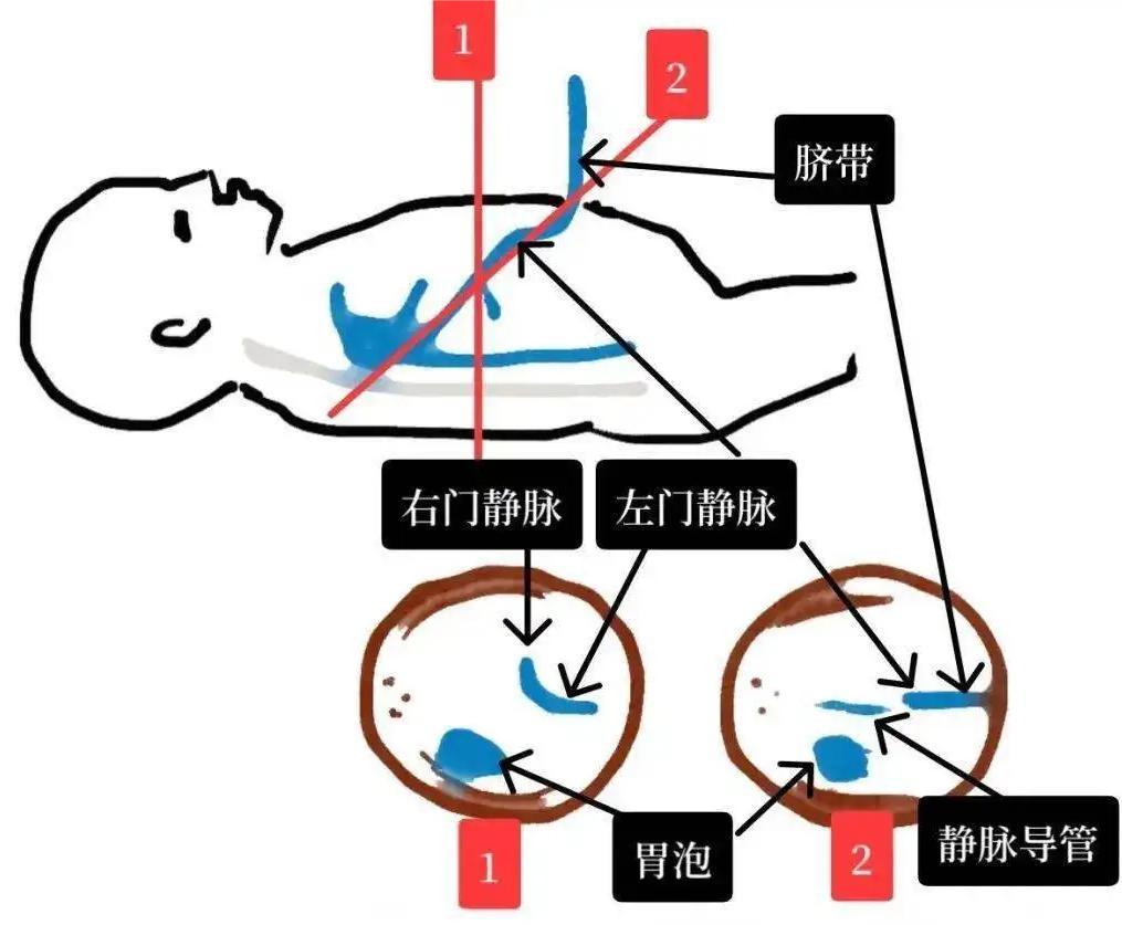 剖宫产麻醉,会不会让我的孩子输在起跑线上