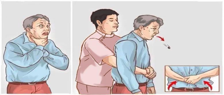 呛到了? 对老人来说很危险!_澎湃号·政务_澎湃新闻-the paper