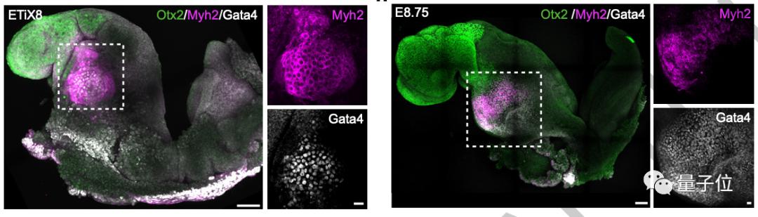 科学家成功培养首个人类胚胎模型_人工培育心脏_胚胎植入大脑实验