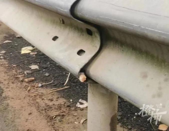 手术车是什么16岁少年骑电瓶车撞护栏，上手术台发现少一块骨头，现场民警急寻回..._https://www.jmylbn.com_新闻资讯_第2张