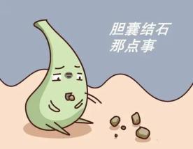 【浦人医·连线】胆囊结石