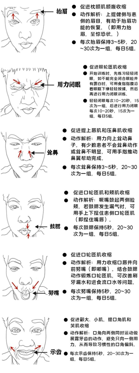 科普 告别面瘫