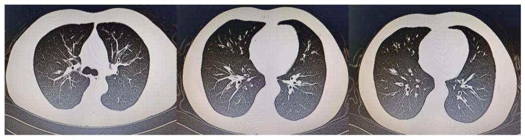 abp在医学是什么意思慢性咳嗽治疗1年仍无效？背后竟是这个病在“作怪”？_https://www.jmylbn.com_新闻资讯_第1张